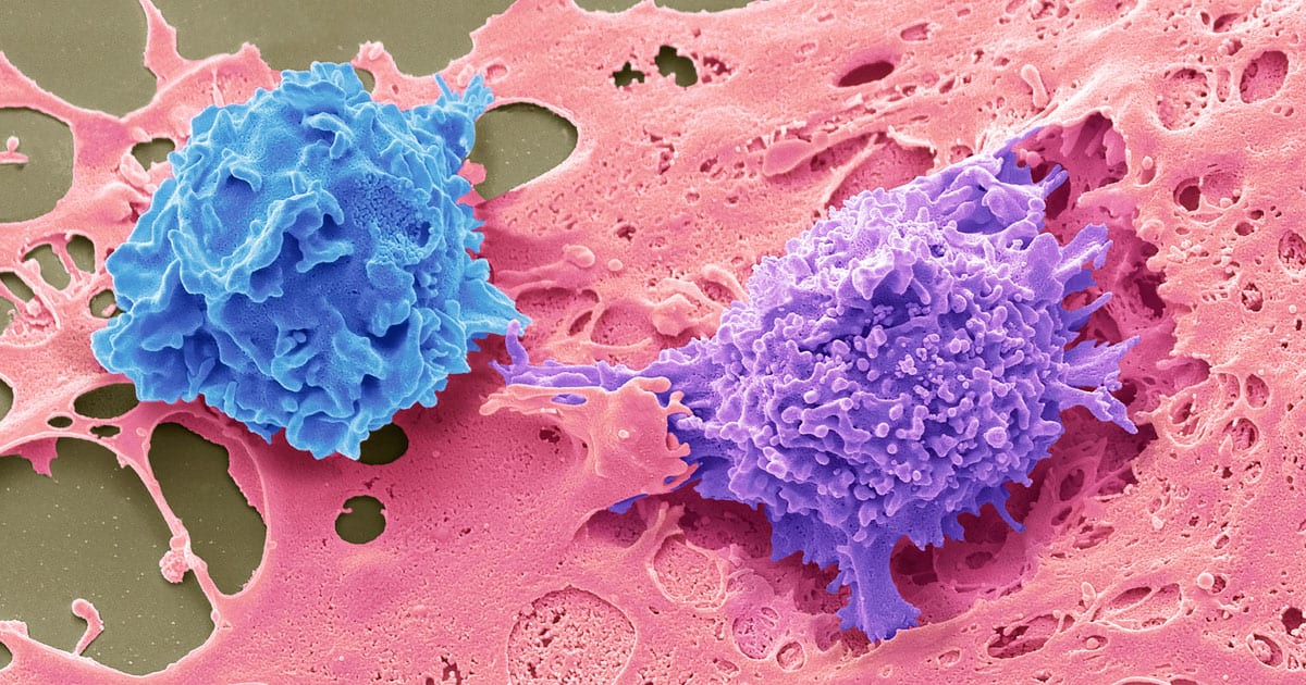 Webinar: Harnessing Natural Killer Cells to Fight Cancer